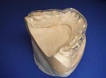 dentures cornwall